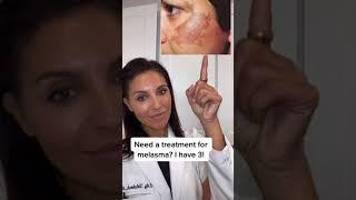 Dermatologist-approved treatment for melasma #shorts