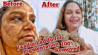 Jaadui Laddu | Pigmentation 100% Removed | Pigmentation Remedy | Cooking with Sultana