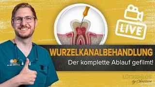 Wurzelkanalbehandlung am Modell - komplett gezeigt #Lückenlos