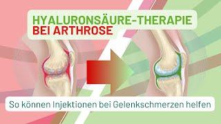 Arthrose verstehen: Die Kraft der Hyaluronsäure - So können Injektionen bei Gelenkschmerzen helfen!