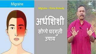 अर्धशिशीवर सोप्पे घरगुती उपाय / Migraine - Home Remedies / Damle Uvach 260