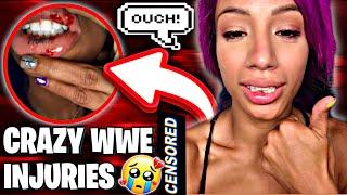 CRAZIEST WWE Superstar Injuries.... OMG! |LegitBossedUp