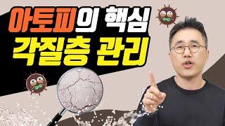 아토피피부염 치료의 핵심은 각질층관리 음식관리만 하지 마세요