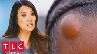 Cyst or Lipoma? Dr. Lee Cuts It Open to Find Out! | Dr. Pimple Popper: A Pimple Carol