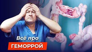 Забудьте о ГЕМОРРОЕ: простые методы лечения геморроя, которые 100% работают!