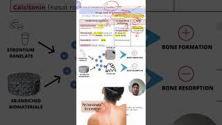 Osteoporosis #targetcms2025 #upsccms2025 #drvarun