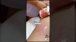 #waxing #green#waxingvideos #waxremoval#wax #waxing #waxmelts #dabs #weed #waxaddict #hairremoval