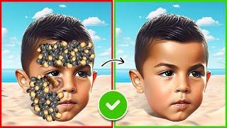 Cristiano Ronaldo | ASMR remove ticks and maggots from Ronaldo Jr | severely injured treatment