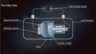 X Ray Production Animation