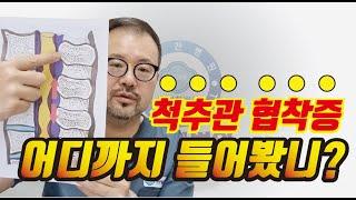 병원에서 진단받는 협착증에 대해서 자세히 알려드립니다. ｜털보의사｜we will inform you in detail about the stenosis