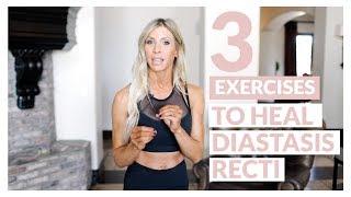 3 Exercises to Heal Diastasis Recti