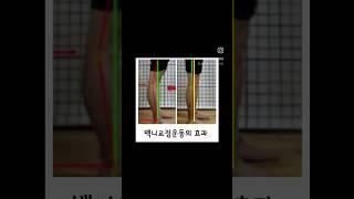 #오다리 #백니 한방에 교정하는 세상에서 가장 쉬운 교정운동법