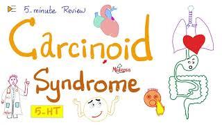 Carcinoid Syndrome | Serotonin-Secreting Tumors | 5-Minute Review 