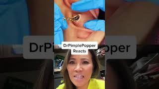 TOO SATISFYING TO BE REAL? Dr Pimple Popper Reacts