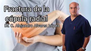 Fractura de la cúpula radial