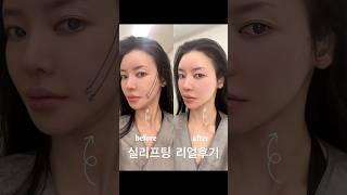 인생 처음 실리프팅 리얼후기 #skincare #실리프팅