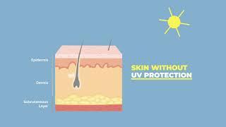 How UV Rays Damage the Skin