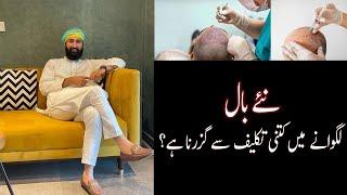 Hair Transplant Kraney Me Kitni Takleef Se Guzarna He? | Muhammad Husnain Vlogs