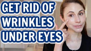 How to GET RID OF UNDER EYE WRINKLES| Dr Dray