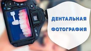 Секреты стоматологии. Дентальная фотография | Как стоматологи фотопротокол изучают | Дентал ТВ