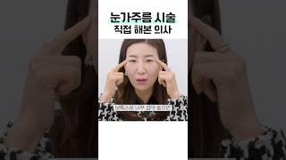 피부과 의사가 직접 눈가주름 보톡스를 맞고 충격받은 이유 #shorts