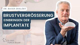 Einbringen von Brustimplantaten: Schnittmethoden bei Brustvergrößerung