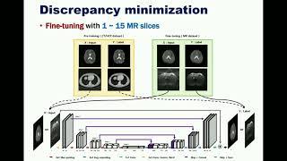 Yo Seob Han: Deep Learning with domain adaptation for accelerated projection-reconstruction MR