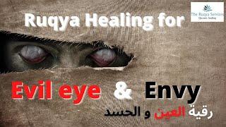 HEAL/DESTROY EVIL EYE AND ENVY (HASSAD)