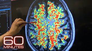 The hope for early detection of Alzheimer's disease