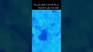 بدترین حس