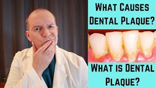 What Causes Dental Plaque? What is Dental Plaque?