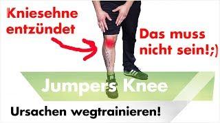 2 Übungen bei Jumpers Knee / Schmerzen unterhalb der Kniescheibe