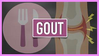 Gout | Emphasis on Diet/Nutrition