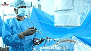 Asian Spine Hospital | Revolutionising Spine Surgery- Dr. Sukumar Sura Full Endoscopic Spine Surgery