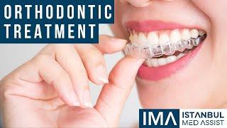 Orthodontic Treatment - Istanbul Medical Assistance