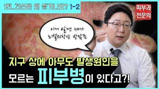 전세계 피부과전문의, 그 누구도 원인을 모르는 피부병이 있다고?! ㅣ 건선, 건선원인, 건선치료