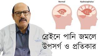 Hydrocephalus | ব্রেইনে পানি জমলে উপসর্গ ও প্রতিকার | Prof. Dr. Md. Zillur Rahman