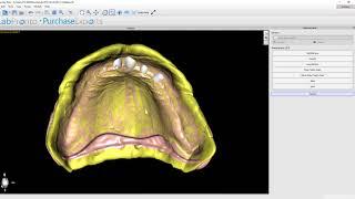 Step 4  Creating and Festooning the Gingival Base in the Blue Sky Plan Denture Module  v 4 7 15