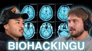 BiohackingU: How Steroids Damage Your Brain & Emotions and How To Prevent & Improve it