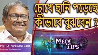 Cataract: Treatment, Symptoms & Blindness Risk || Prof. (Dr.) Asim Kumar Ghosh || Ophthalmologist
