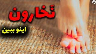 با 13 دلیل خطرناک خارش بدن در 5 دقیقه آشنا شو