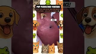 Wow! #pimplepopping #pimple #pimples #shortsfeed #shortvideo #shorts #short #youtube #youtubeshorts
