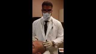 Scalp Micro Pigmentation with Dr William Yates