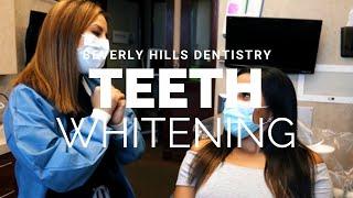 Cosmetic Teeth Whitening | Beverly Hills Dentistry