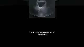 #узи #армдиассистент #турп