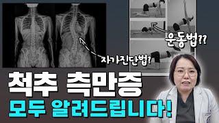 척추 측만증 모두 알려드립니다! #통증 #측만증 #통증치료 #scoliosis #측만증치료 #측만증운동