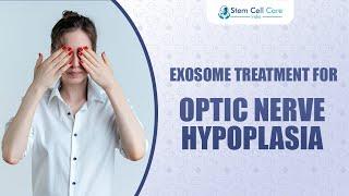 Exosome Treatment For Optic Nerve Hypoplasia | Best Stem Cell Center For Eye Disease |Vision Restore