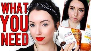 ACCUTANE STARTER KIT! Must-have Products while on Isotretinoin