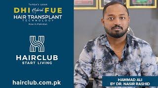 Hybrid FUE Hair Transplant with DHI Technology by Hair Club