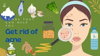 10 FOODS TO EAT FOR CLEARER SKIN: THE ULTIMATE ACNE DIET PLAN